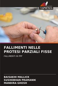 Produktbild: FALLIMENTI NELLE PROTESI PARZIALI FISSE