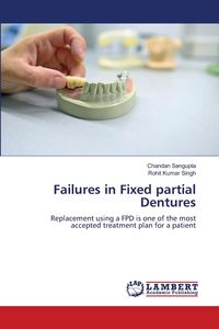 Produktbild: Failures in Fixed partial Dentures
