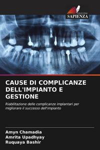Produktbild: Cause Di Complicanze Dell'impianto E Gestione
