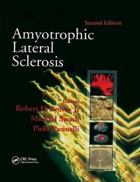 Produktbild: Amyotrophic Lateral Sclerosis, Second Edition