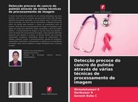 Produktbild: Detec&ccedil;&atilde;o precoce do cancro do pulm&atilde;o atrav&eacute;s de v&aacute;rias t&eacute;cnicas de processamento de imagem