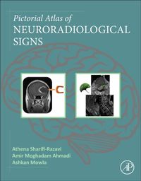 Produktbild: Pictorial Atlas of Neuroradiological Signs