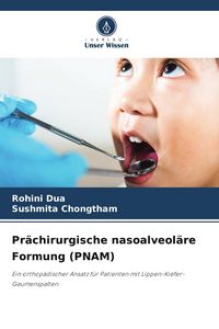 Produktbild: Pr&auml;chirurgische nasoalveol&auml;re Formung (PNAM)