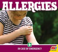 Produktbild: Allergies