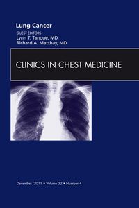Produktbild: Lung Cancer, An Issue of Clinics in Chest Medicine