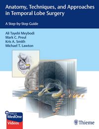 Produktbild: Anatomy, Techniques, and Approaches in Temporal Lobe Surgery