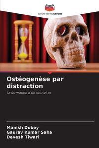 Produktbild: Ost&eacute;ogen&egrave;se par distraction