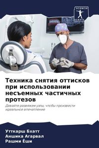 Produktbild: Tehnika snqtiq ottiskow pri ispol'zowanii nes#emnyh chastichnyh protezow