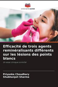 Produktbild: Efficacit&eacute; de trois agents remin&eacute;ralisants diff&eacute;rents sur les l&eacute;sions des points blancs
