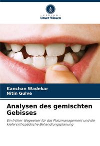 Produktbild: Analysen des gemischten Gebisses