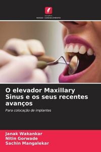 Produktbild: O elevador Maxillary Sinus e os seus recentes avan&ccedil;os