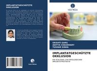 Produktbild: Implantatgesch&uuml;tzte Okklusion