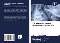 Produktbild: Gigantokletochnye porazheniq chel&uuml;stej