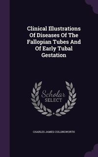 Produktbild: Clinical Illustrations Of Diseases Of The Fallopian Tubes And Of Early Tubal Gestation