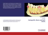 Produktbild: Autografts: Bone and Soft tissue