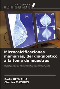 Produktbild: Microcalcificaciones mamarias, del diagn&oacute;stico a la toma de muestras