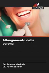 Produktbild: Allungamento della corona
