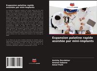 Produktbild: Expansion palatine rapide assist&eacute;e par mini-implants
