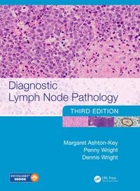 Produktbild: Diagnostic Lymph Node Pathology