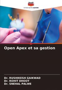 Produktbild: Open Apex et sa gestion
