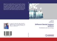 Produktbild: Different Dental implant systems