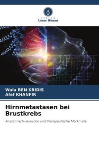 Produktbild: Hirnmetastasen bei Brustkrebs