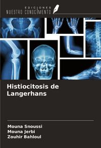 Produktbild: Histiocitosis de Langerhans