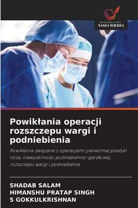 Produktbild: Powik&iquest;ania operacji rozszczepu wargi i podniebienia
