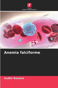 Produktbild: Anemia falciforme