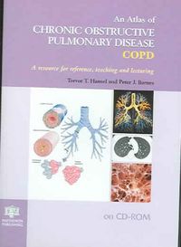 Produktbild: Atlas of Chronic Obstructive Pulmonary Disease