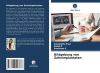 Produktbild: Bildgebung von Zahnimplantaten