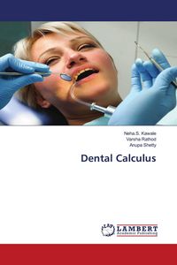 Produktbild: Dental Calculus