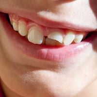 Produktbild: Smiling Through The Pain