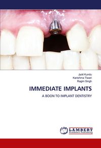 Produktbild: Immediate Implants