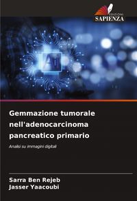 Produktbild: Gemmazione tumorale nell'adenocarcinoma pancreatico primario