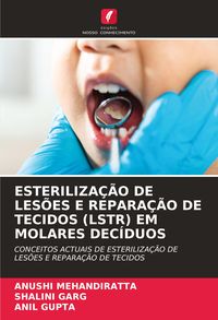 Produktbild: Esteriliza&ccedil;&atilde;o De Les&otilde;es E Repara&ccedil;&atilde;o De Tecidos (lstr) Em Molares Dec&iacute;duos