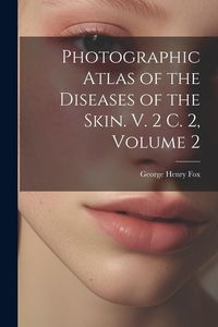 Produktbild: Photographic Atlas of the Diseases of the Skin. V. 2 C. 2, Volume 2