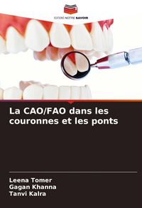 Produktbild: La CAO/FAO dans les couronnes et les ponts