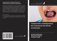 Produktbild: Comprensi&oacute;n contempor&aacute;nea del tratamiento del diente avulsionado
