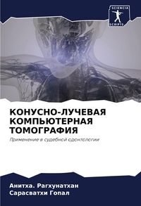 Produktbild: Konusno-Luchevaya Komp'juternaya Tomografiya