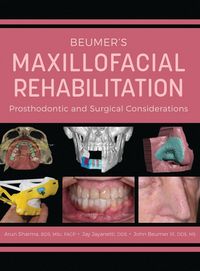 Produktbild: Beumer's Maxillofacial Rehabilitation