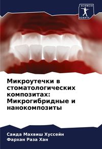 Produktbild: Mikroutechki w stomatologicheskih kompozitah: Mikrogibridnye i nanokompozity