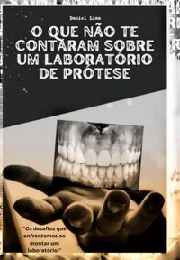 Produktbild: O Que N&atilde;o Te Contaram Sobre Um Laborat&oacute;rio De Pr&oacute;tese