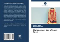 Produktbild: Management des offenen Apex