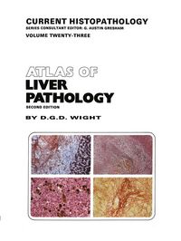Produktbild: Atlas Of Liver Pathology Rev/e