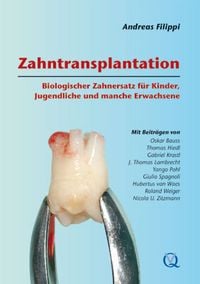 Produktbild: Zahntransplantation