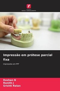 Produktbild: Impress&atilde;o em pr&oacute;tese parcial fixa