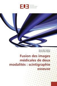 Produktbild: Fusion des images m&eacute;dicales de deux modalit&eacute;s : scintigraphie osseuse