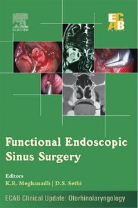 Produktbild: Functional Endoscopic Sinus Surgery - ECAB - E-Book