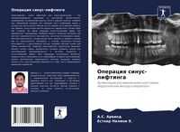 Produktbild: Operaciq sinus-liftinga
